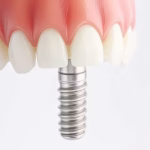 72ff003e-85d4-40fd-b4dd-df4de7d9306a